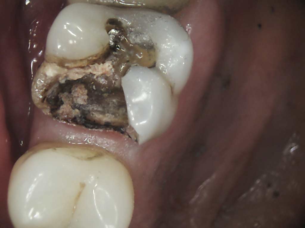 Office Blog Dr. Al Villalobos Jupiter & Tequesta Dentist